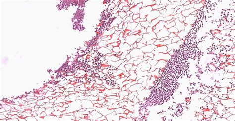 PC3 cell line (prostate) – Cytomatrix