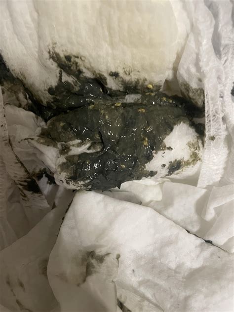 Is my baby’s poop normal? : r/newborns