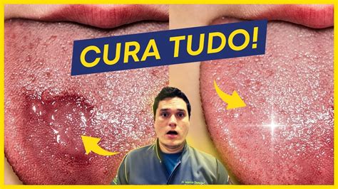 Mordi A Lingua O Que Fazer - MORDI MINHA LINGUA! E AGORA, O QUE FAZER? - YouTube