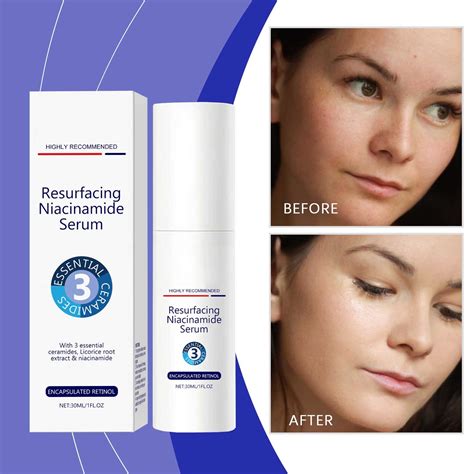 Skin Creaming Lotion Multiple Creases Compact Moisturizing Moisturizing