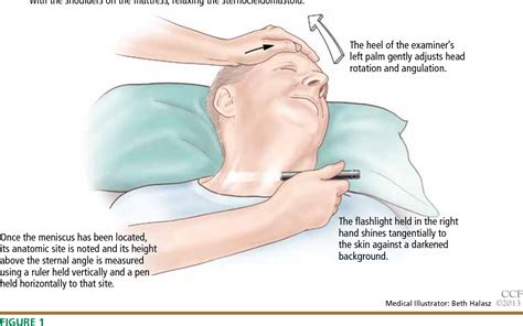 Measure Jugular Venous Pressure