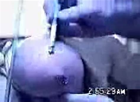 Burning Her Tits Cigarette Tit ThisVid