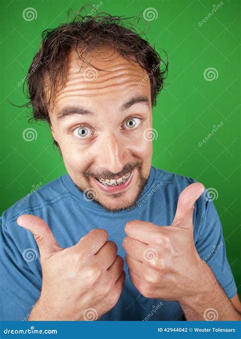 Happy Man with Braces Putting His Thumbs Up for You Stock Photo - Image