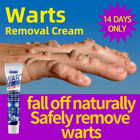 Skin Tag Removal Cream Flat Wart Genital Warts Filiform Wart Plantar Wart Remover Cream