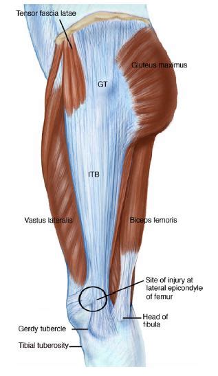 Iliotibial Band Syndrome Core Balance Therapy