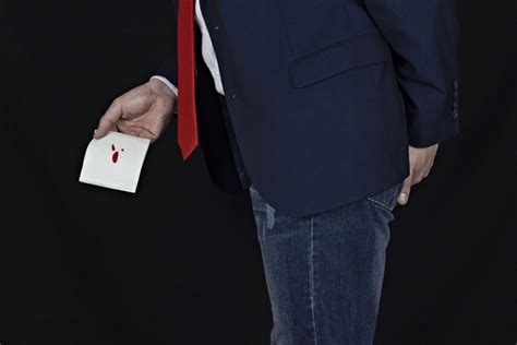 Basur Hemoroid ve Anal Fistül Ameliyat Yöntemleri ve Ameliyatsız Tedavi Seçenekleri