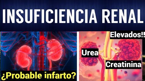 Insuficiencia Renal Aguda Y Cr Nica Fisiopatolog A S Ntomas Y