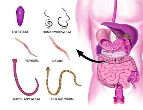 Types of intestinal worms:, Symptoms, Cause, Risks & Treatment (in ...