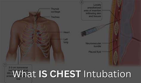 What Is Chest Intubation Dr Muneeb Ullah Expert Surgeon In