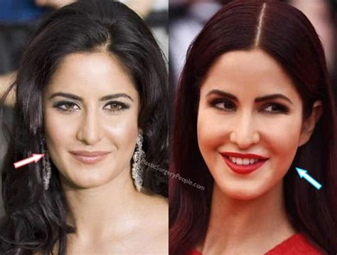 Did Katrina Kaif Have Surgery To Look Hot