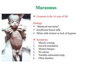malnutrition consequences  prevention  control pptx