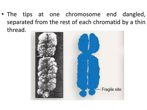 Sex Chromosome Disorders PPTX