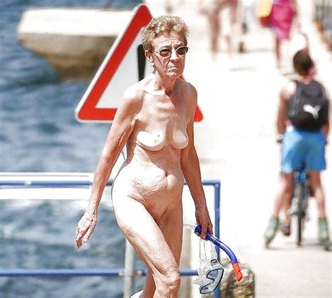 Stretch Marks Scars And Saggy Porn Pictures XXX Photos Sex Images PICTOA