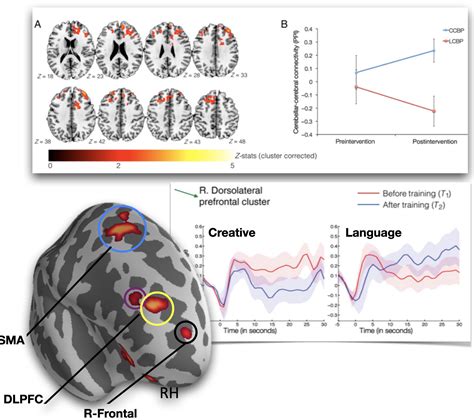 Observed Brain Dynamics 10
