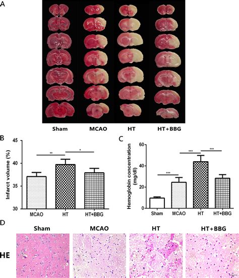 P2X7 Receptor Agonist Reduced HG Induced Infarct Volume And Hemorrhagic