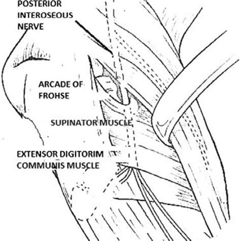 Image Demonstrating The Path Of The Posterior Interosseous Nerve Download Scientific Diagram