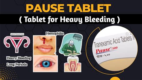 Pause Tablet Tablets For Abnormal Bleeding Uses And Side Effects