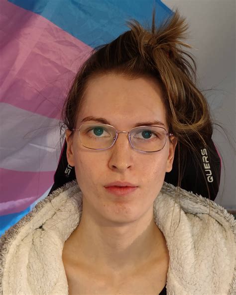 What FFS do i need? : asktransgender