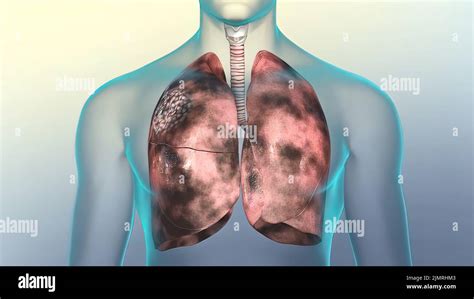 Anatomía e histología pulmonar humana Banque de photographies et d