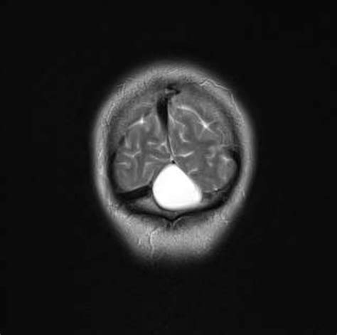 cistopng teonanacatlorg