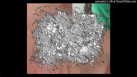 Anal Bacteria Anal Freaks Full Youtube