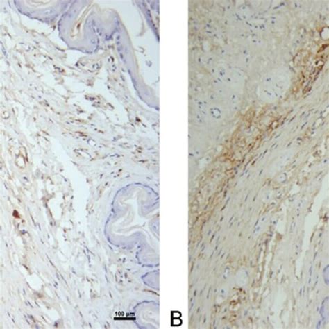 Expression Of Alpha Smooth Muscle Actin And Type Iii Collagen In Rat Download Scientific