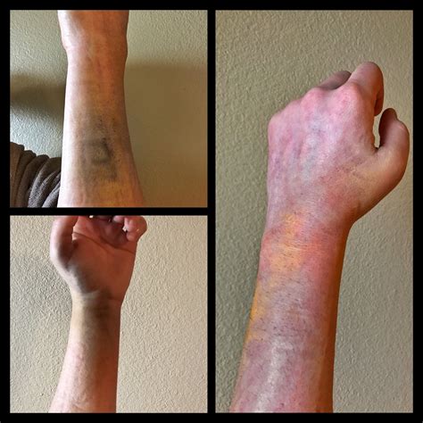 Wrist break — Michael S. Parker | Online Personal Trainer