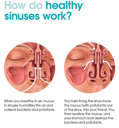 how to open sinus