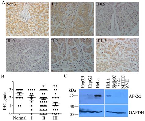 Ap Inhibits Hepatocellular Carcinoma Cell Growth And Migration