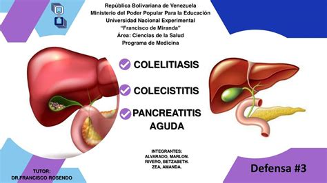 Colecistitis Colelitiasis Pancreatitis Aguda Betzabeth Rivero