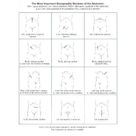 خرید و قیمت دانلود کتاب Ultrasound Teaching Manual The Basics Of Performing And Interpreting