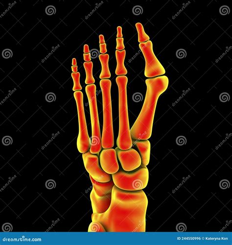 Hallux Valgus Icd 10 3