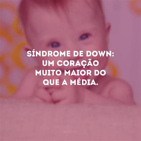35 frases sobre Síndrome de Down pois o amor não conta cromossomos
