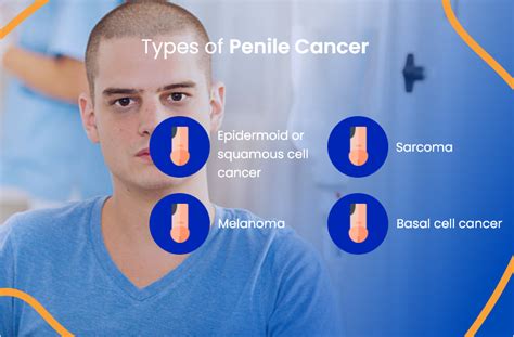 Penile Cancer Treatment Everything You Need To Know Actc