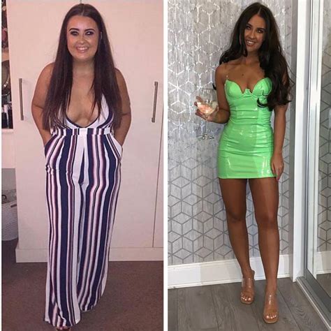 Woman Goes Viral With Bikini Photo Flaunting Weight Loss Transformation News Au