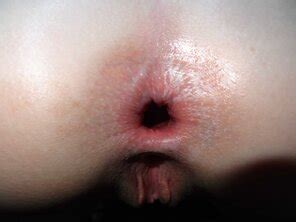 Amateur Gape Porn Pic