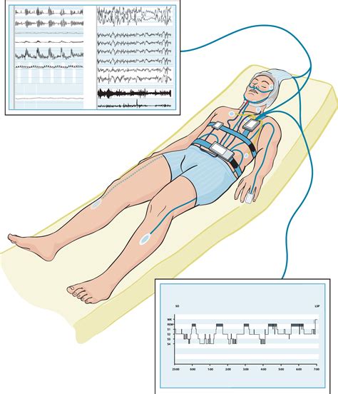 Biomedinformatics Free Full Text Unobtrusive Monitoring Of Sleep