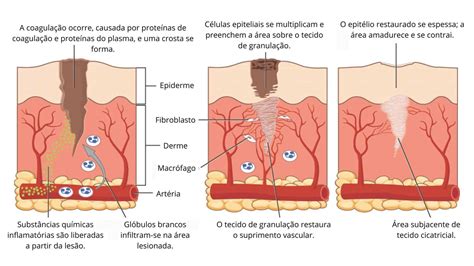 Feridinhas No Corpo O Que Pode Ser