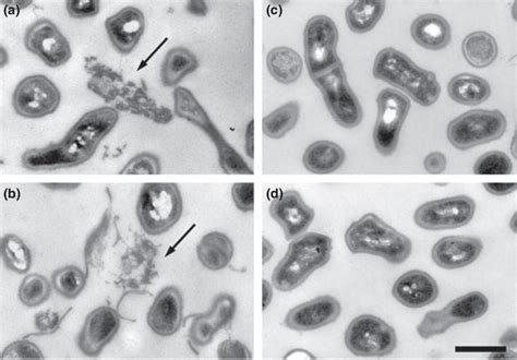 Figure 5 from Biofilm formation by Propionibacterium acnes is a characteristic of invasive ...