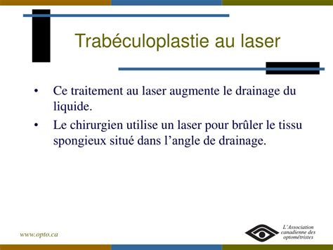 Ppt Glaucome Powerpoint Presentation Free Download Id1710099