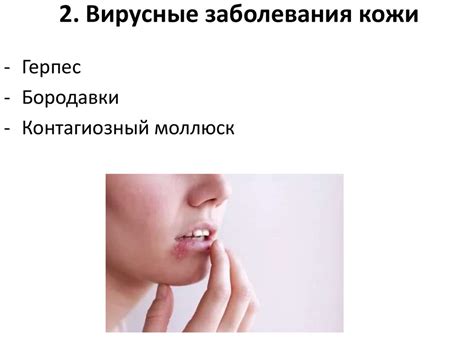 Санитария и гигиена парикмахерских услуг: Кожные заболевания ...