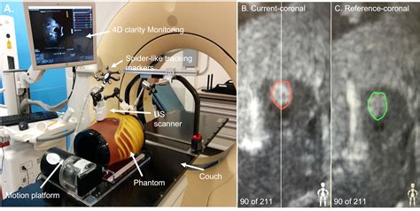 Frontiers A Phantom Based Analysis For Tracking Intra Fraction