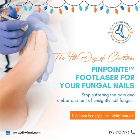 5th Day of Christmas: Stop Suffering From Ingrown Toenails in Frisco