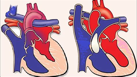 Paciente Pedi Trico Con Cardiopat A Cong Nita Para Cirug A No Cardiaca