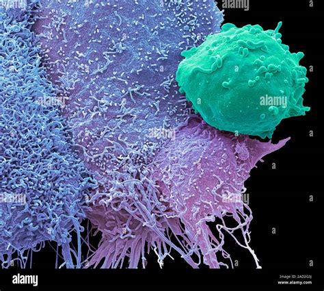 Cancer Cells And Monocyte Coloured Scanning Electron Micrograph Sem