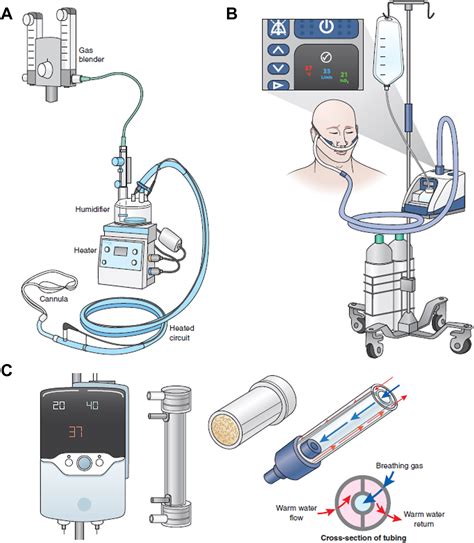 Mechanical Ventilation and Respiratory Support in the Pediatric ...