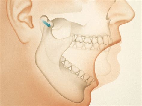 Clicking Jaw – Mansion House Dental Practice