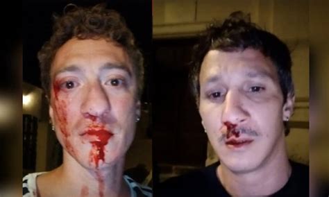 Pareja Gay Estando De Vacaciones Es Brutalmente Atacada Plaza Diversa