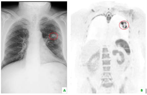 Diagnostics Free Full Text Whole Body Mri With Diffusion Weighted