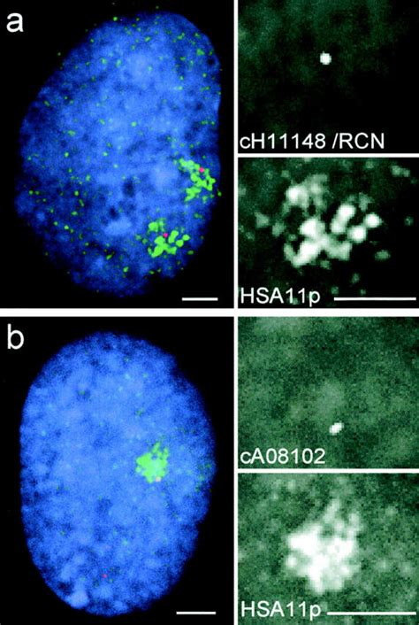 Chromosome territory substructure. FISH of the cH11148 cosmid probe ...